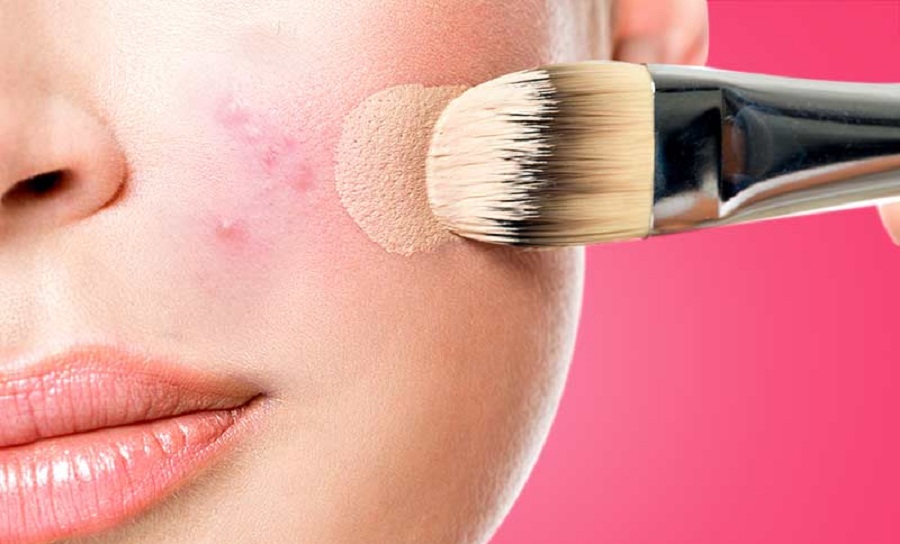 Expert Recommendations for Makeup with Acne Prone Skin